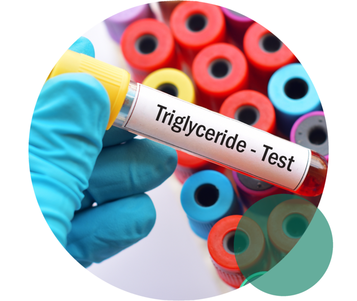 Eine Hand mit blauem Einweghandschuh hält ein Probenröhrchen mit der Aufschrift „Triglyceride-Test“. Dahinter sind die Deckel weiterer Probenröhrchen zu sehen. 