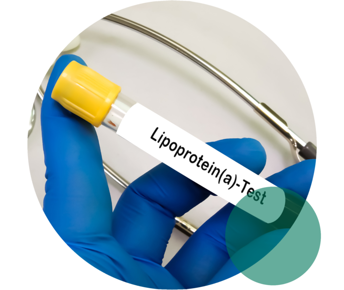 Eine Hand mit blauem Einweghandschuh hält ein Probenröhrchen mit der Aufschrift „Lipoprotein(a)-Test“.