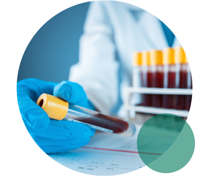 Eine Person mit weißem Kittel und in blauen Einweghandschuhen hält in beiden Händen jeweils ein gefülltes Blutröhrchen. Vor der Person stehen weitere Röhrchen in einem Ständer.