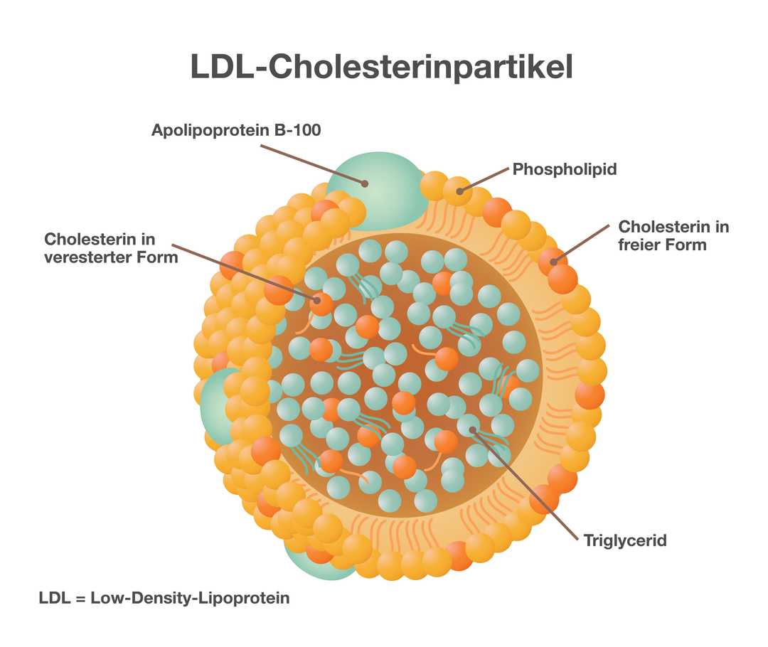 Schematische Darstellung eines LDL-Cholesterinpartikels. Sie zeigt eine große gelbliche Kugel. Die Hülle der Kugel besteht aus vielen gelben, orangen und einzelnen grünen Kugeln. Die gelben Kugeln stellen Phospholipide dar, die orangen Cholesterin in freier Form. Die grünen Kugeln stehen für Apolipoprotein B-100. Im Inneren der großen Kugel befinden sich weitere grüne und orange Kugeln. Die grünen stehen für Triglyceride, die orangen für Cholesterin in veresterter Form. Unten links im Bild steht der Text „L