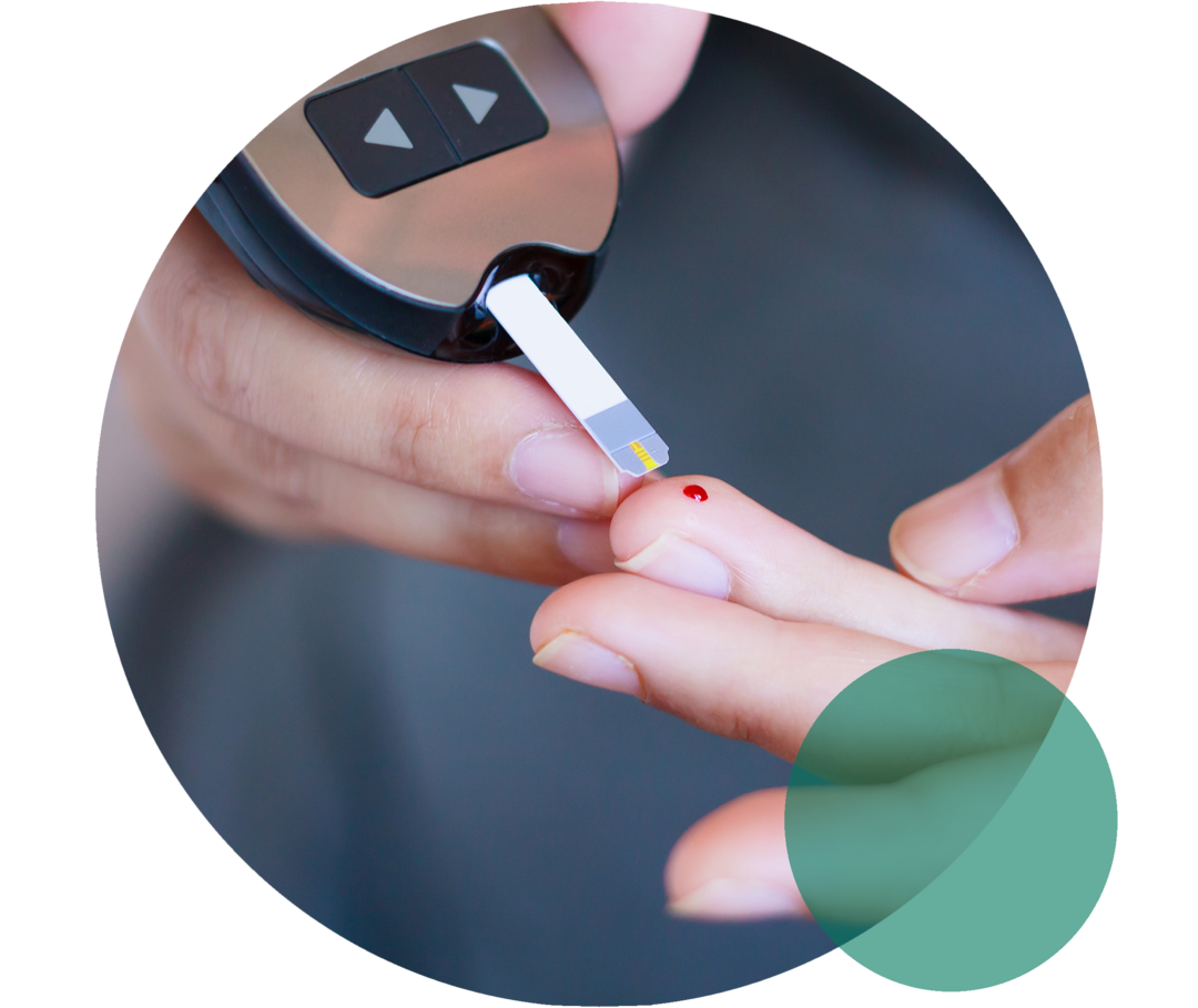 Hände einer Person. Die rechte Hand hält ein Blutzuckermessgerät mit unbenutztem Teststreifen. Ein Finger der linken Hand wird an den Teststreifen gehalten. An der Fingerkuppe ist eine rötliche Flüssigkeit zu sehen.