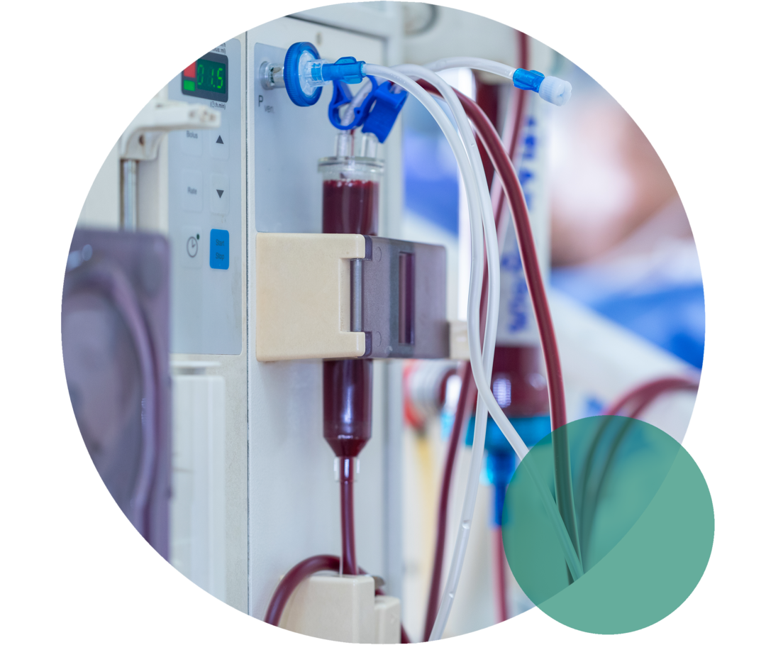 Das Bild zeigt einen Blutpfropf