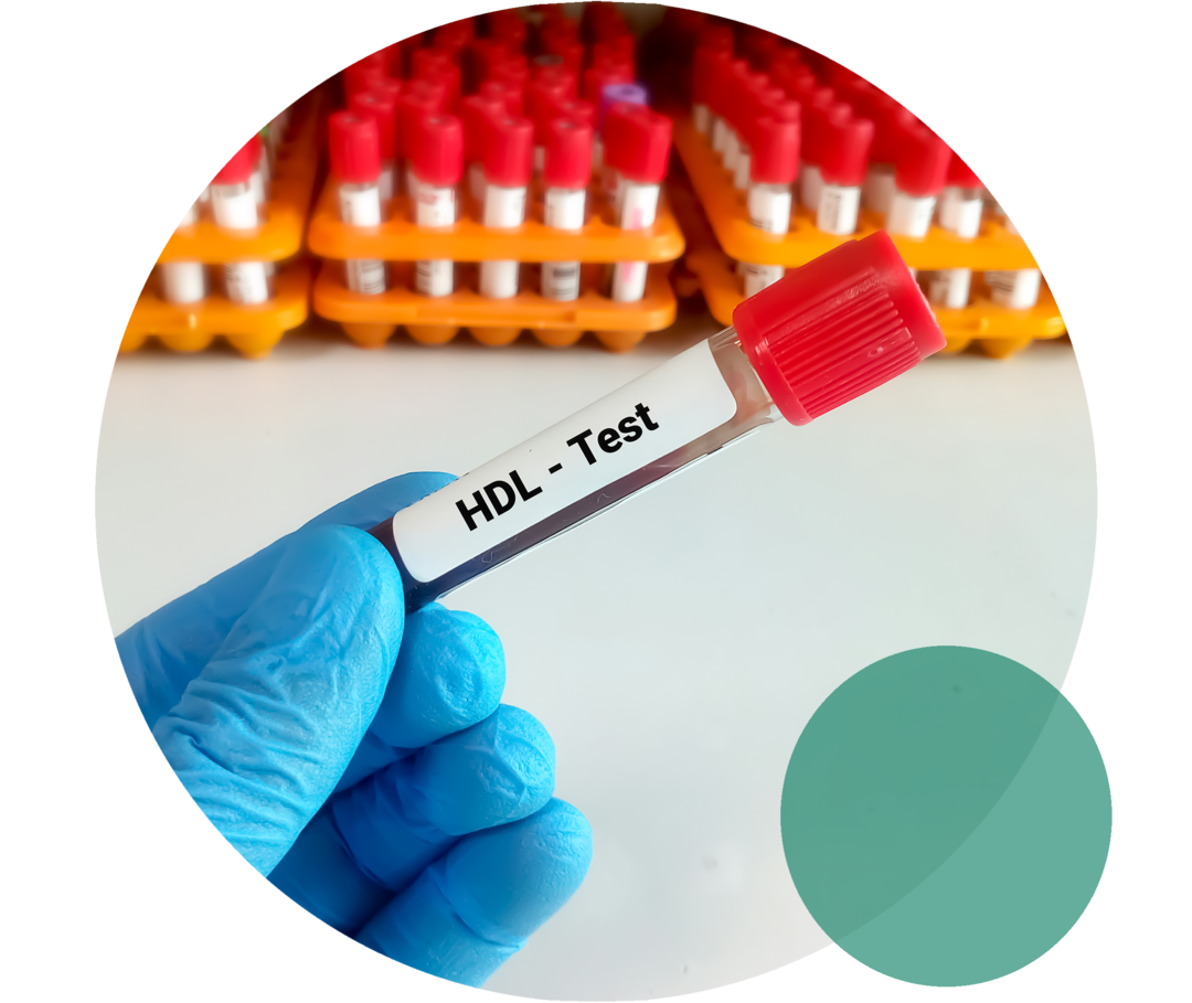 Eine Hand mit blauem Einweghandschuh hält ein Probenröhrchen mit der Aufschrift „HDL-Test“.