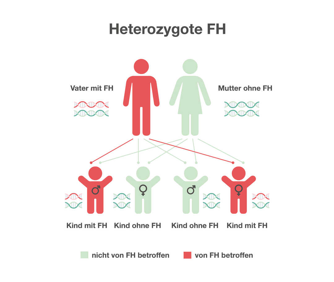 Grafik mit der Überschrift „Heterozygote FH“. Sie zeigt, wie die familiäre Hypercholesterinämie vererbt wird. Die familiäre Hypercholesterinämie wird meist nur von einem Elternteil und dominant vererbt, sodass 50 Prozent der Kinder eines betroffenen Elternteils Träger dieser Fettstoffwechselstörung sind.